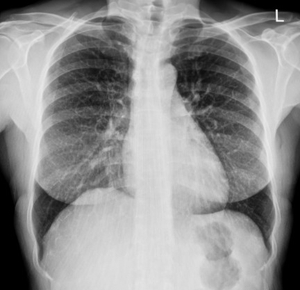 Imagen diagnóstica de Radiología (RX)